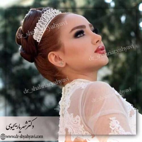 جراحی-زیبایی-بینی-25