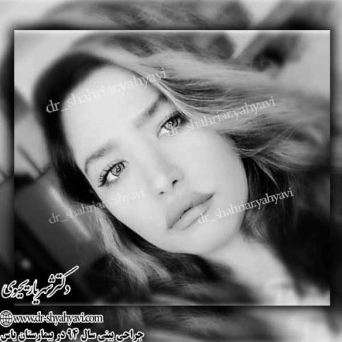 جراحی-زیبایی-بینی-7