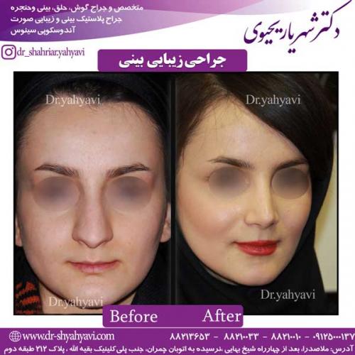 جراحی-زیبایی-بینی