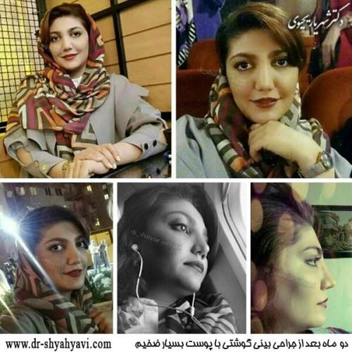 جراحی بینی 192