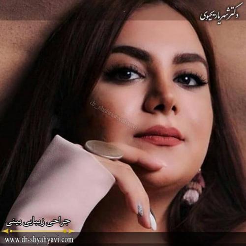 جراحی بینی 197