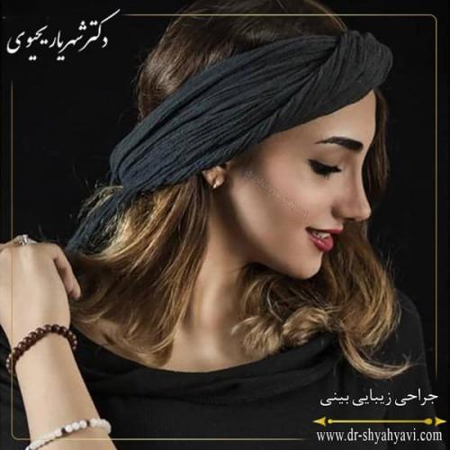 جراحی بینی 198