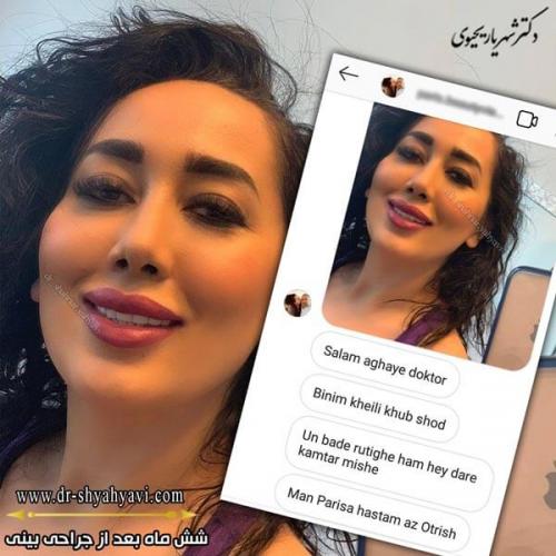 جراحی بینی 201