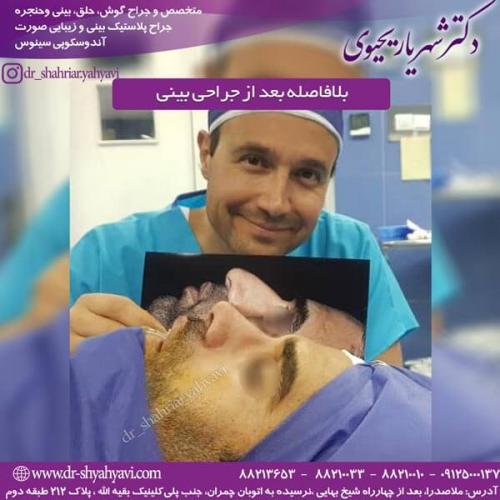 جراحی بینی 202