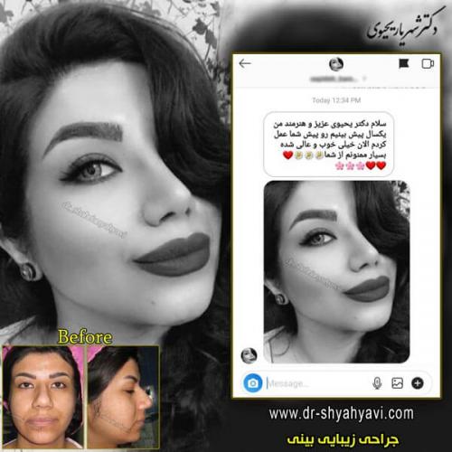 جراحی بینی 203