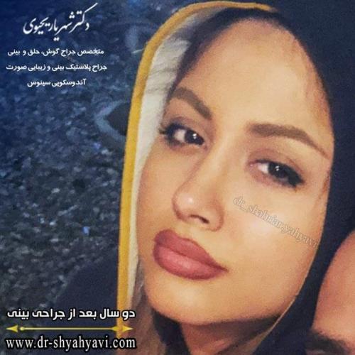 جراحی بینی 208