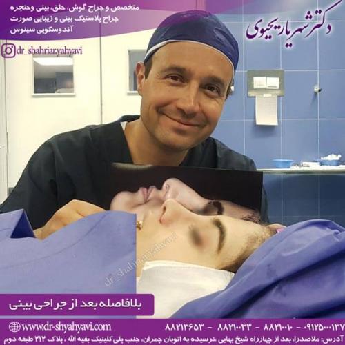 جراحی بینی 209