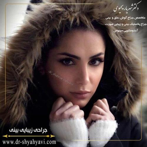 جراحی بینی 210