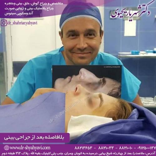 جراحی بینی 212