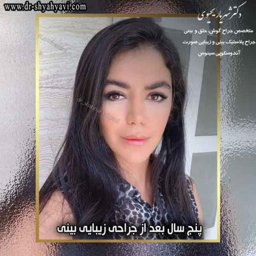 جراحی بینی 213