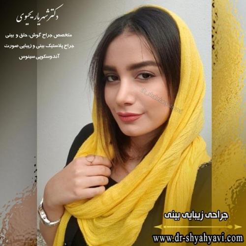 جراحی بینی 214