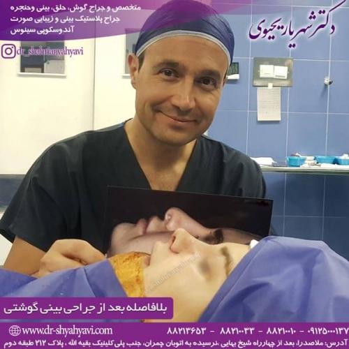 جراحی بینی 220