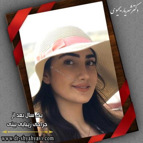 جراحی بینی 223