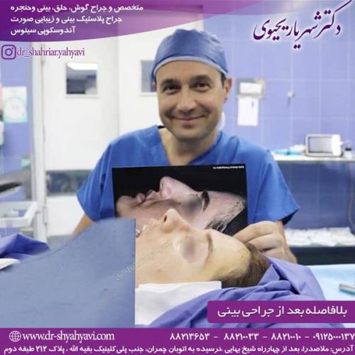 جراحی بینی 225