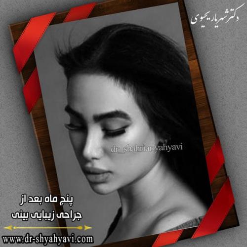 جراحی بینی 226