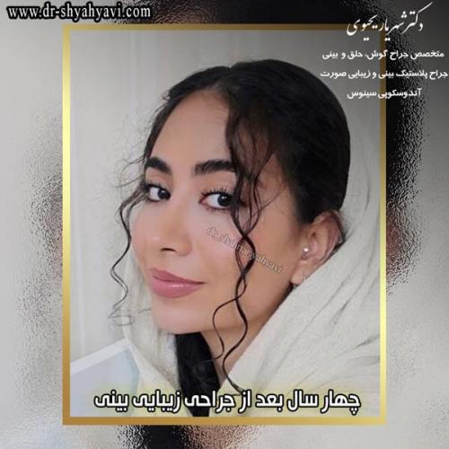 جراحی بینی 227