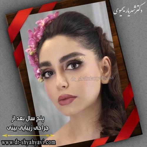 جراحی بینی 229