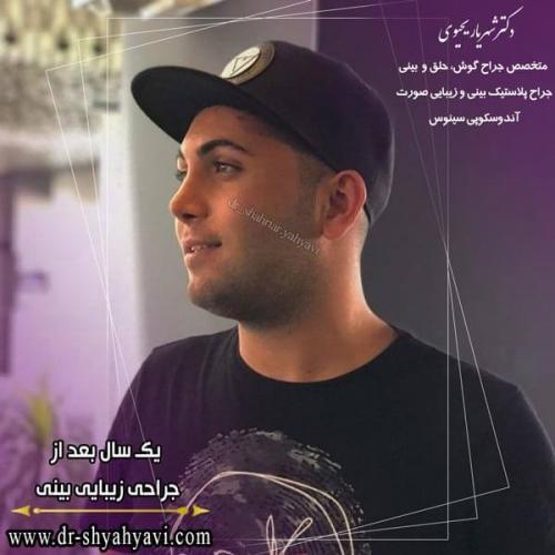 جراحی بینی 230