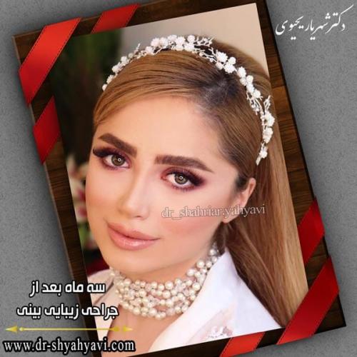 جراحی بینی 232