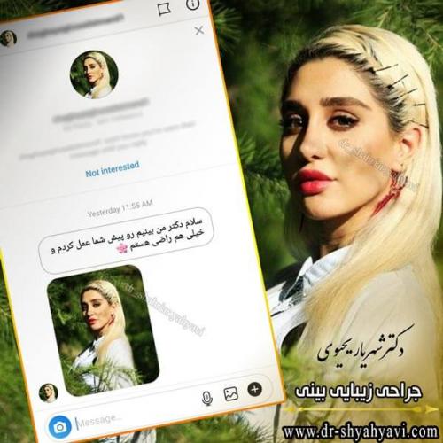 جراحی بینی 233