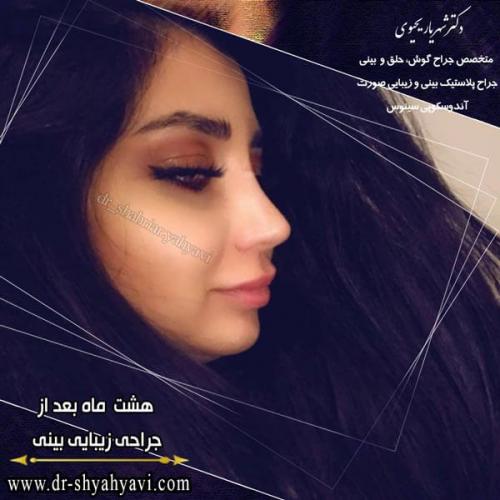 جراحی بینی 234