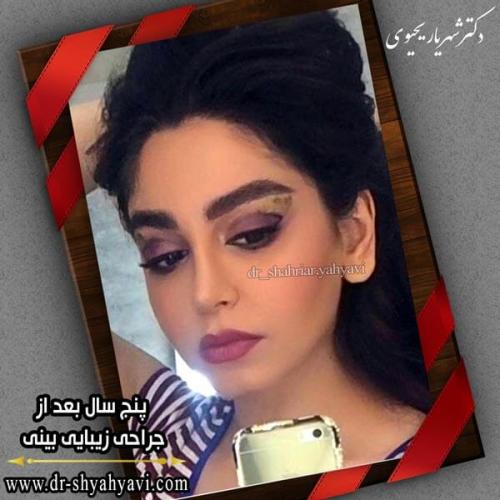 جراحی بینی 243