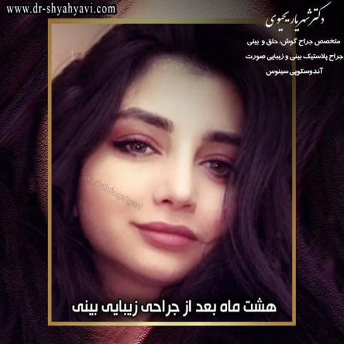 جراحی بینی 244