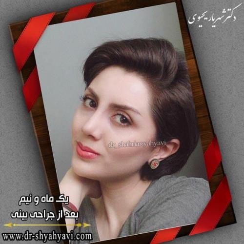 جراحی بینی 246