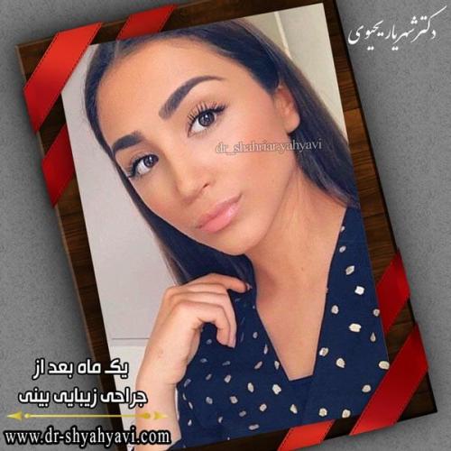 جراحی بینی 249