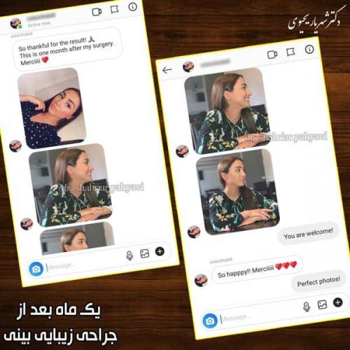 جراحی بینی 250