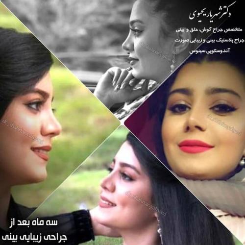 جراحی بینی 257