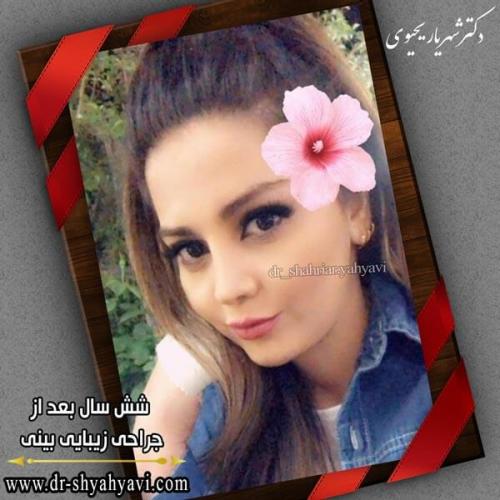 جراحی بینی 259