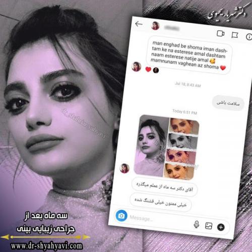 جراحی بینی 260