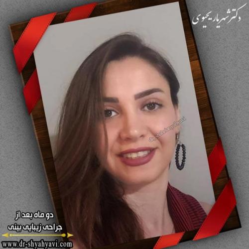 جراحی بینی 261