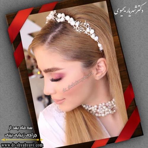 جراحی بینی 263