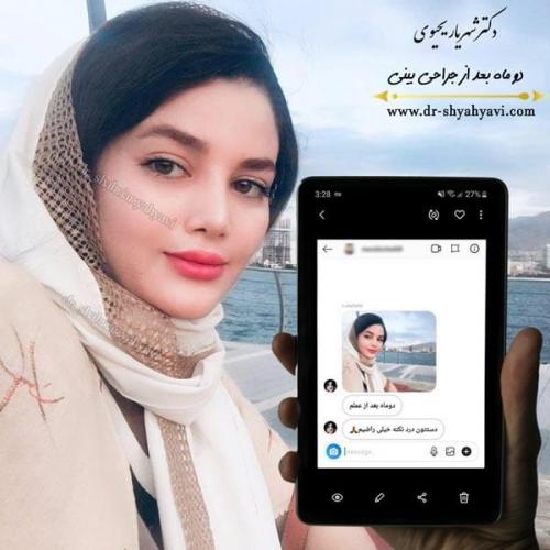 جراحی بینی 268