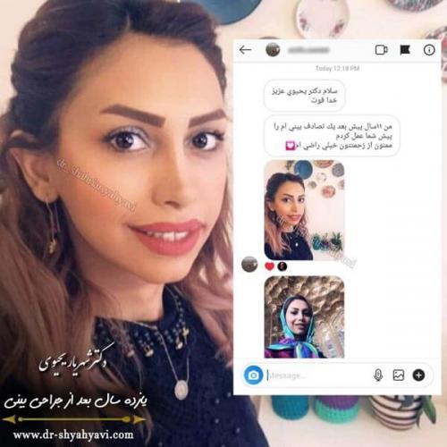 جراحی بینی 271