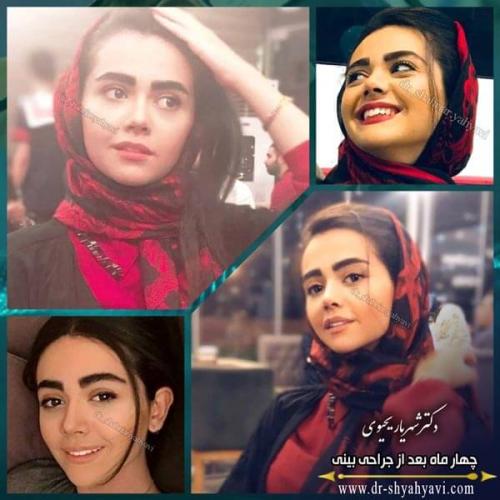 جراحی بینی 273