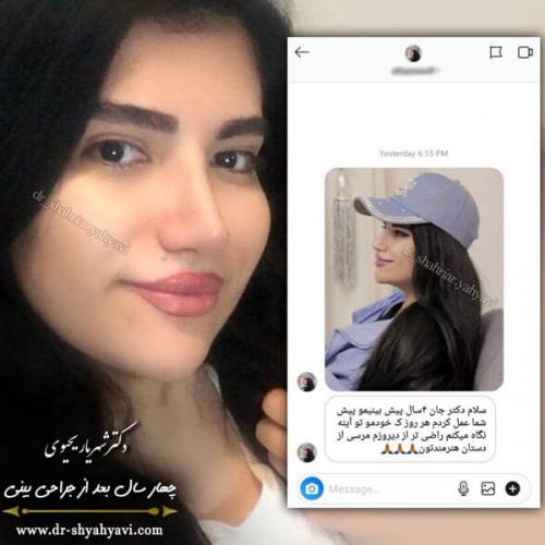 جراحی بینی 274