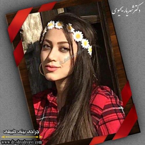 جراحی بینی 275