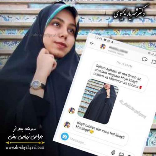 جراحی بینی 301