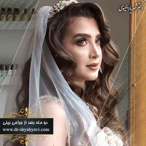 جراحی بینی 309