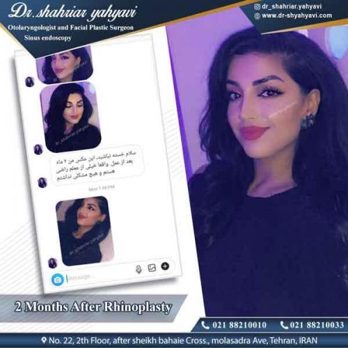 جراحی بینی 314