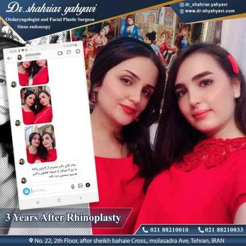 جراحی بینی 317