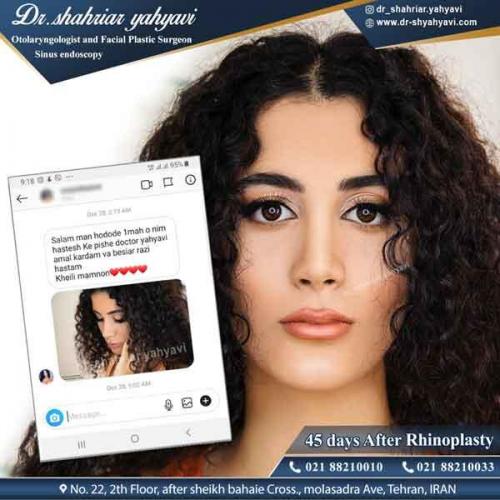 جراحی بینی 320