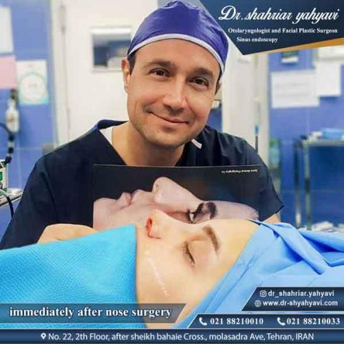 جراحی بینی 328