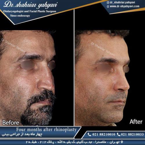 جراحی بینی 365