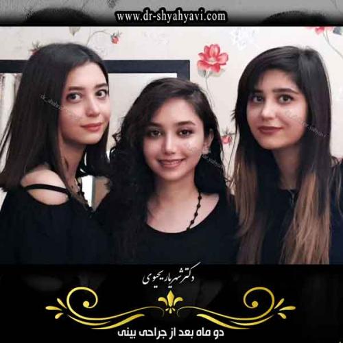 جراحی بینی 399