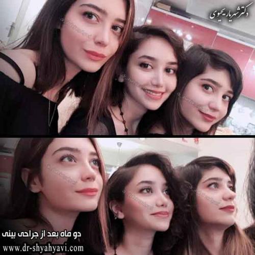 جراحی بینی 400