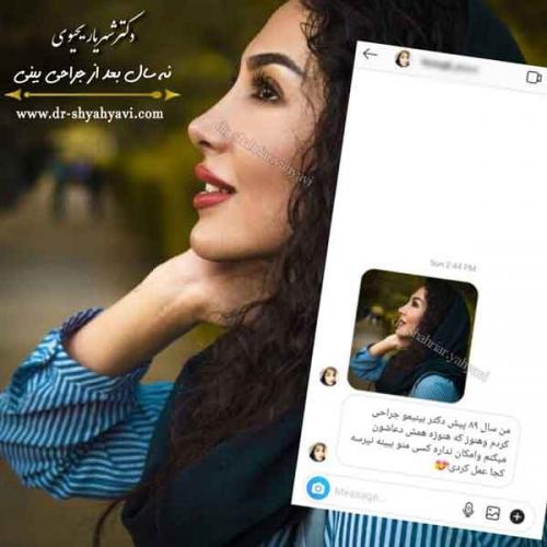 جراحی بینی 401